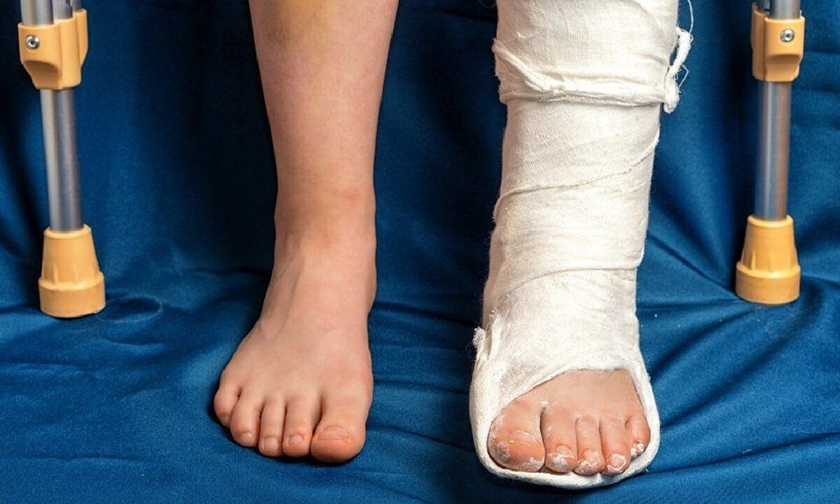 Don't do this mistake in Fracture