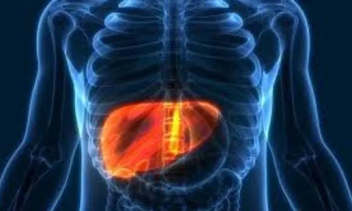Fatty Liver,