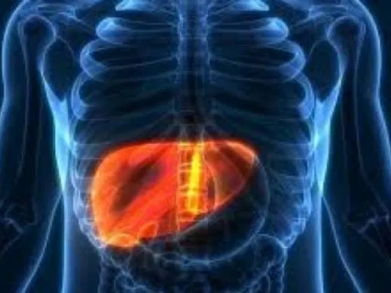 Fatty Liver,