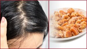 White Hair Treatment