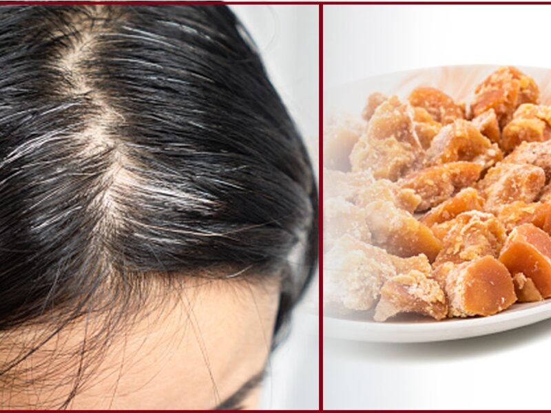 White Hair Treatment