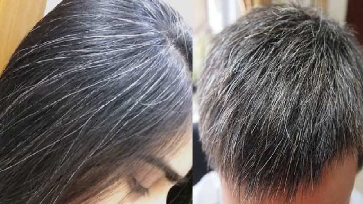 White Hair Treatment