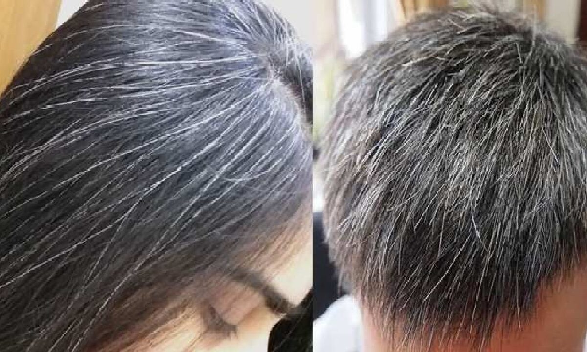 White Hair Treatment