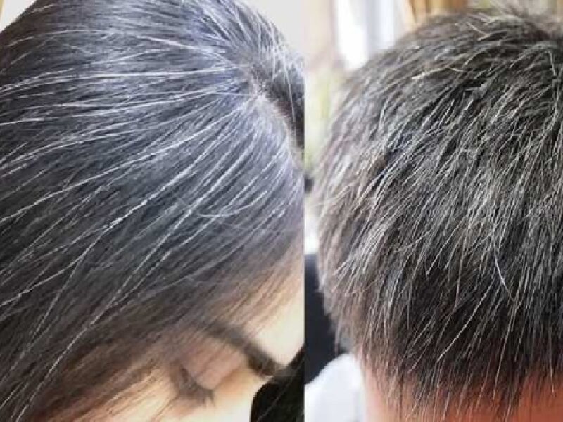 White Hair Treatment