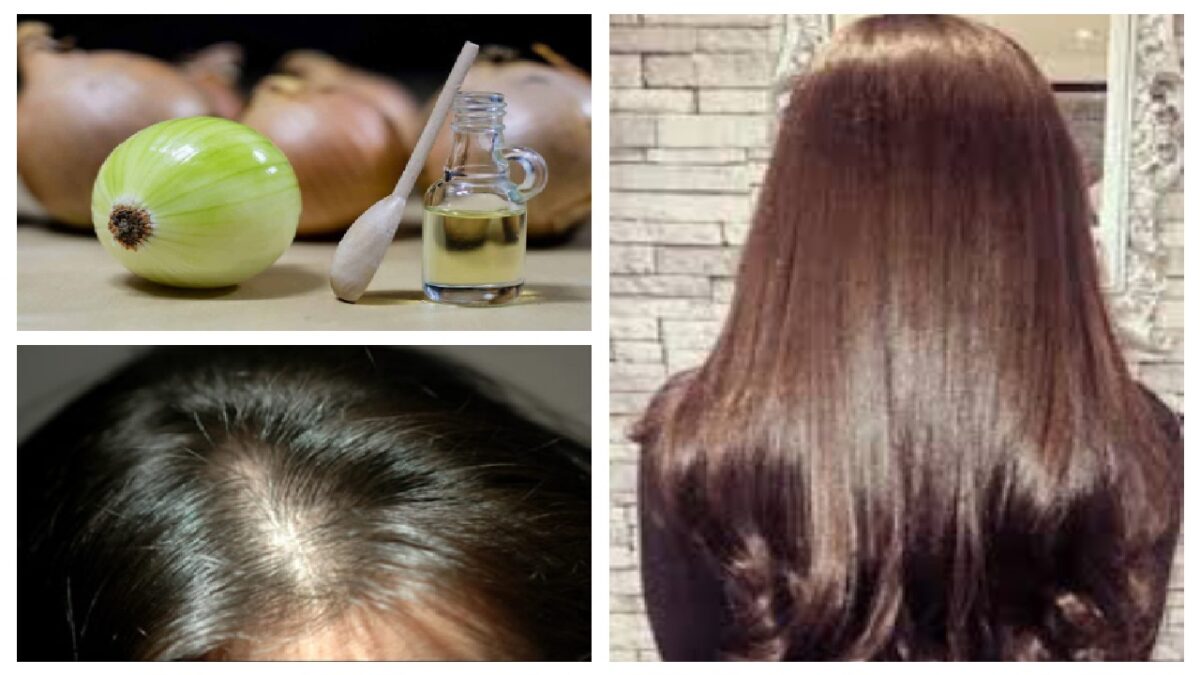Hair Fall Home Remedies