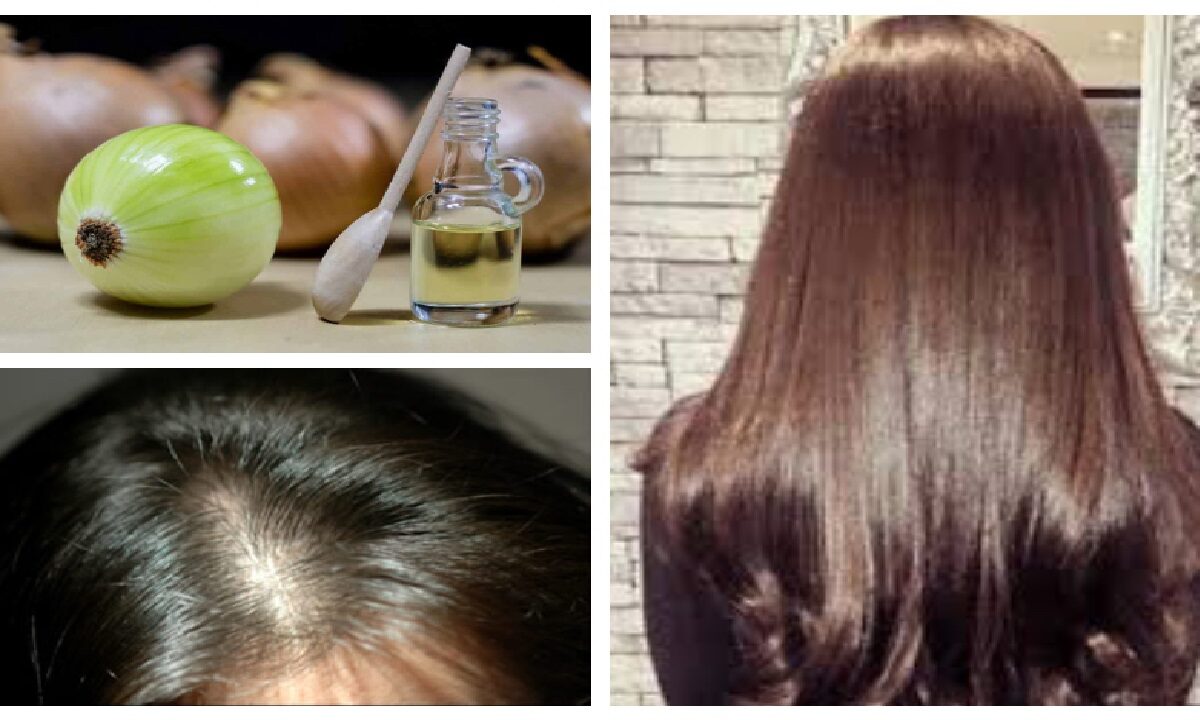 Hair Fall Home Remedies