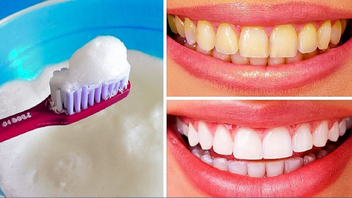 teeth whitening home remedies