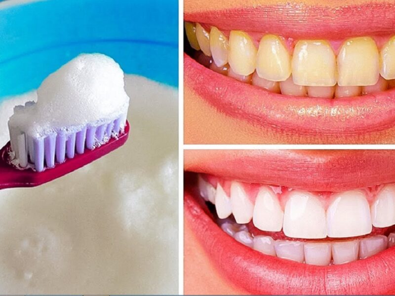 teeth whitening home remedies