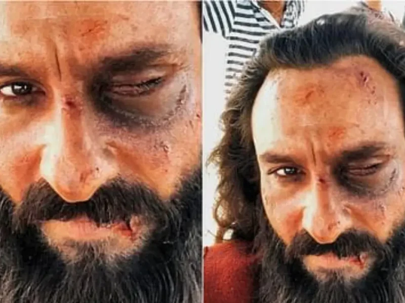 Saif Ali Khan Health