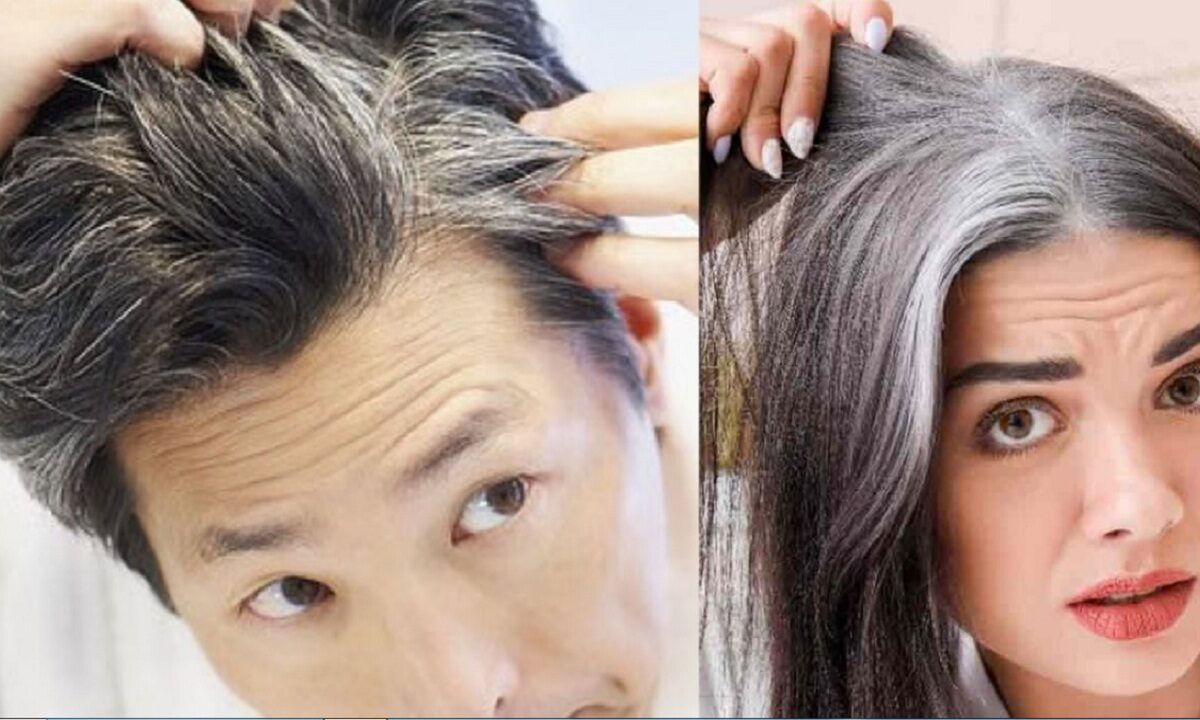 gray hair problem