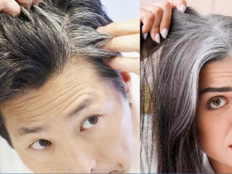 gray hair problem