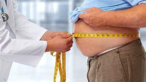 obesity treatments