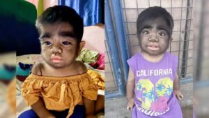 Do Not Eat These Thing During Pregnancy