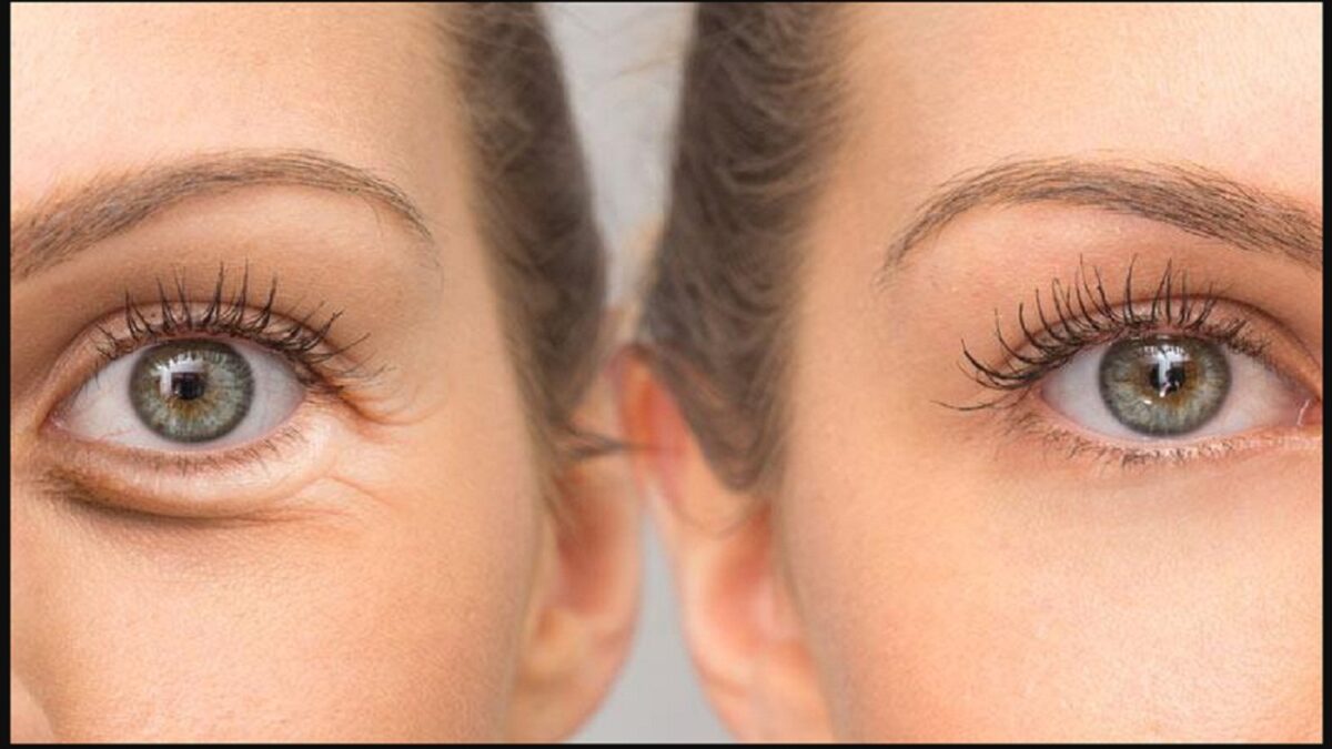 coconut oil for skin