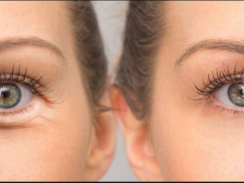 coconut oil for skin