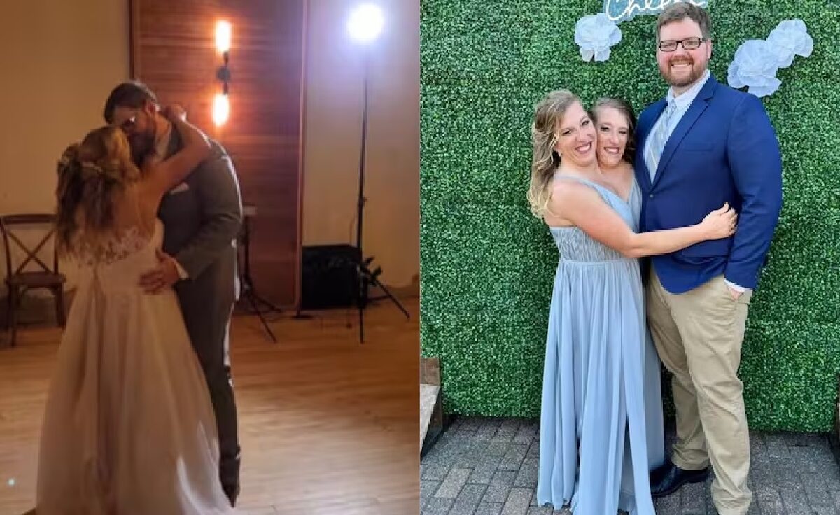 conjoined twins marriage