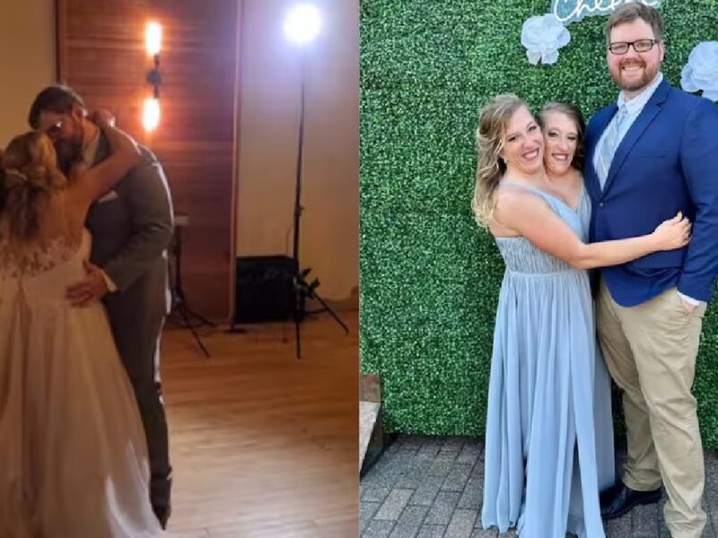 conjoined twins marriage