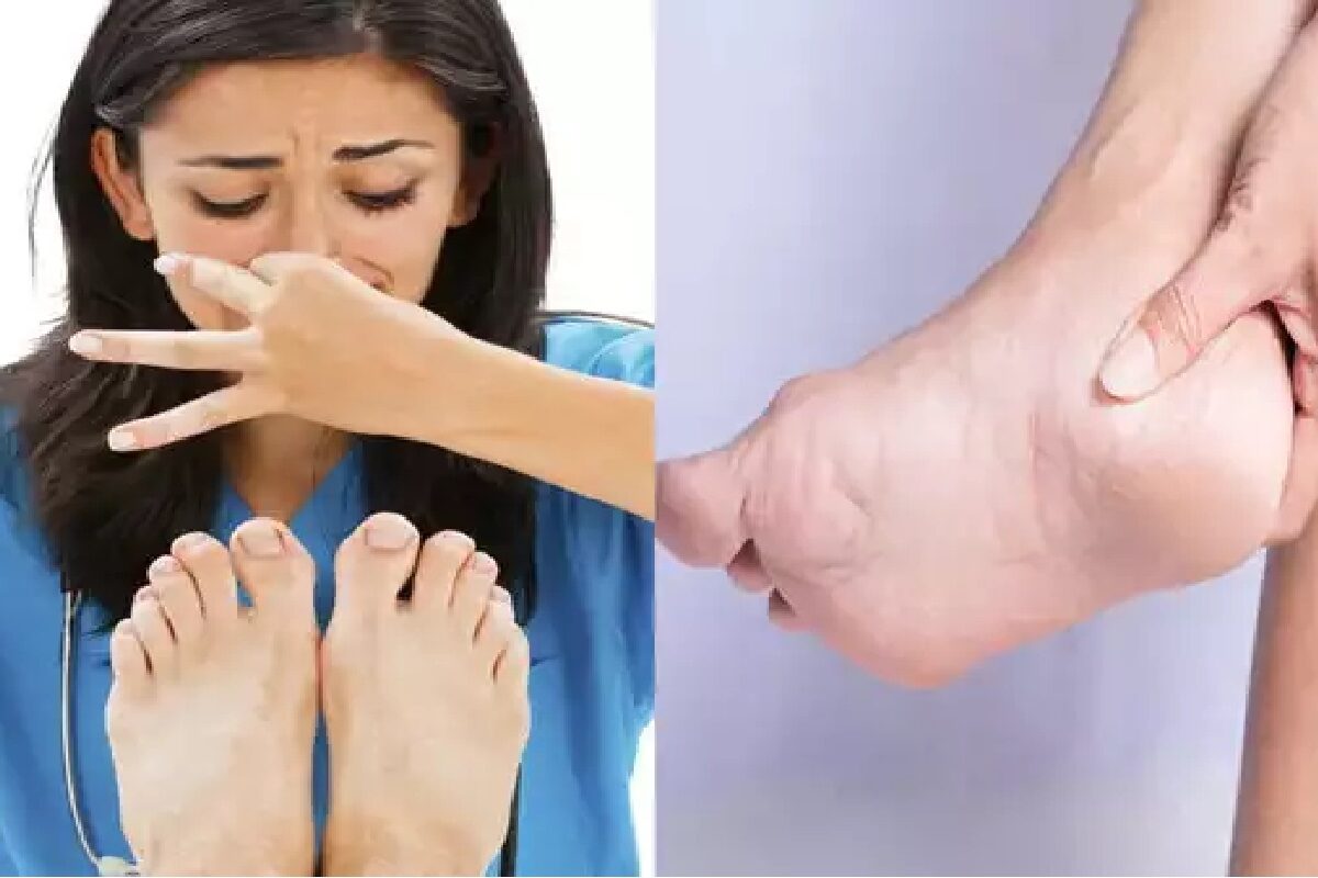 Feet Smell Issue