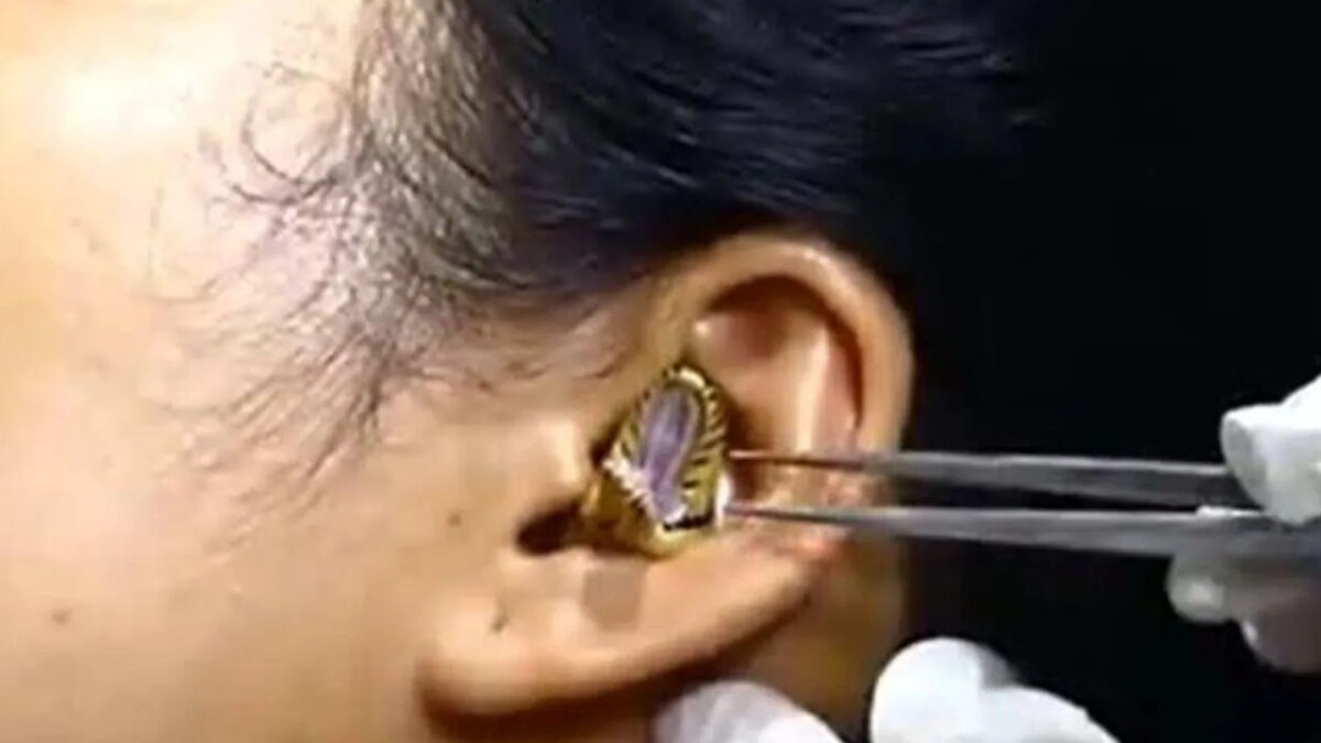 snake in ear
