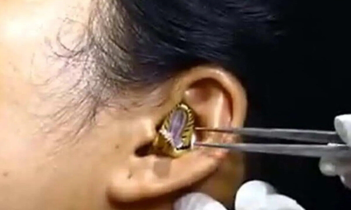 snake in ear