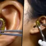 snake in ear